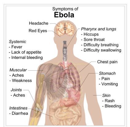 Ebola symptoms, wikimedia