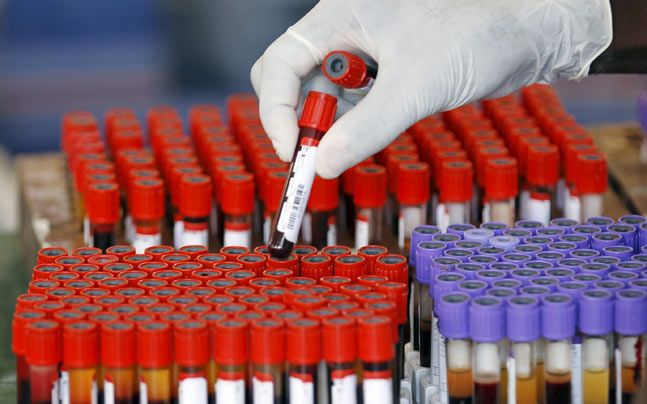 California may test all young kids for lead exposure | CalWatchdog.com